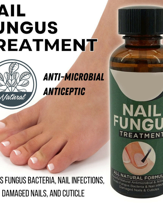 Anti Fungal Nail Treatment Nail Finger Toe Fungus Onychomycosis Remover - Vibes Harmony